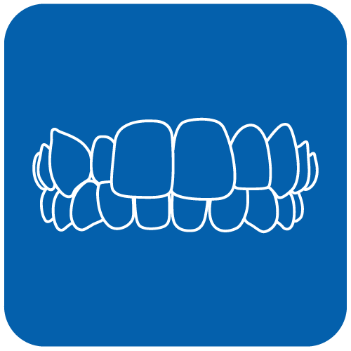 23QUI-Invisalign-casos-19