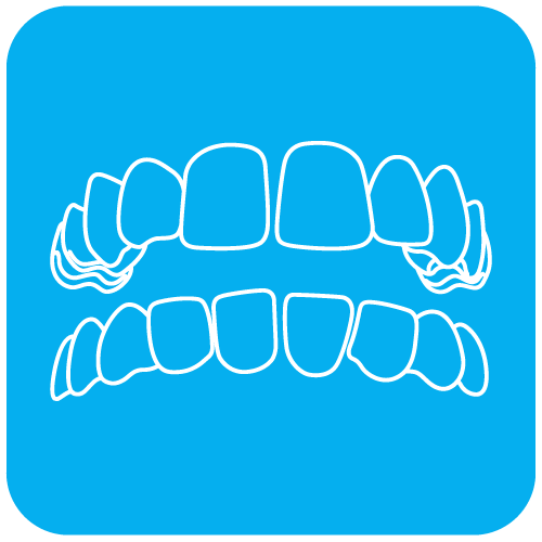 23QUI-Invisalign-casos-20