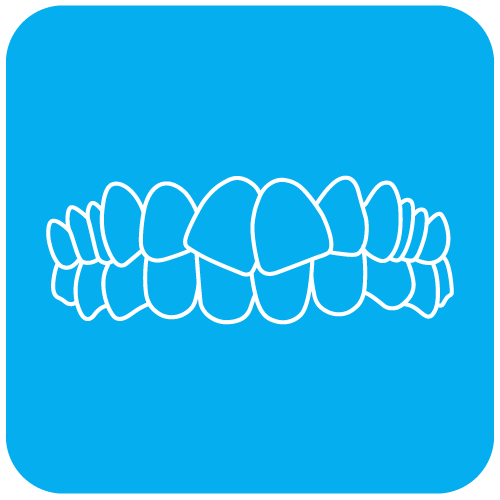 23QUI-Invisalign-casos-23